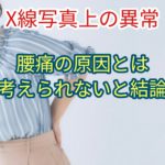 X線写真上の異常は「腰痛」の原因とは考えられないと結論