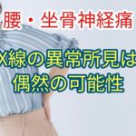 腰痛下肢痛患者のX線の異常所見は偶然の可能性
