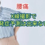 X線撮影は腰痛発症を予測できない