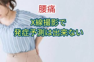 X線撮影は腰痛発症を予測できない