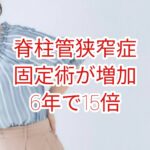 脊柱管狭窄症：固定術が増加6年で15倍