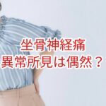 坐骨神経痛の異常所見は偶然？