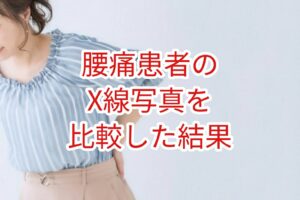 腰痛患者のX線写真を比較した結果