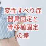 [変性すべり症」器具固定と骨移植固定の差