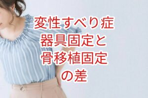 [変性すべり症」器具固定と骨移植固定の差