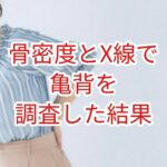 骨密度とＸ線撮影で脊柱後湾(亀背)を調査した結果