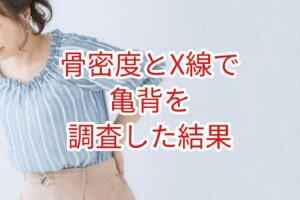 骨密度とＸ線撮影で脊柱後湾(亀背)を調査した結果