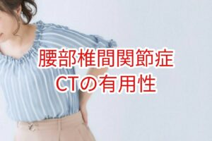 【腰部椎間関節症】CTの有用性
